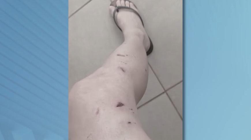 Mulher é atacada por dez cães em Rio Preto
